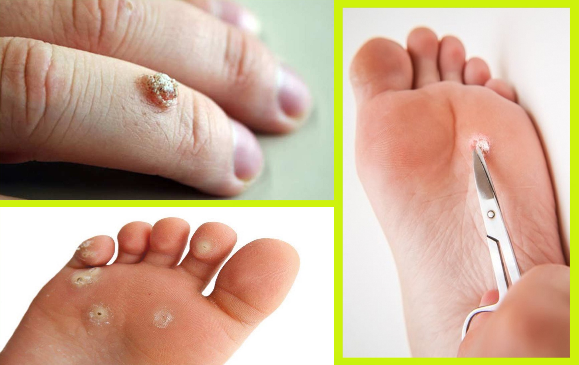 ကြွက်နို့